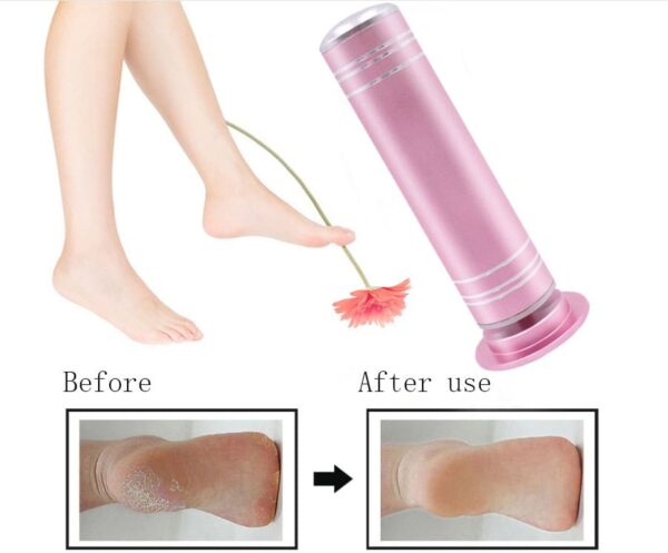 Electric Callus Shavers, Adjustable Speed Foot File Pedicure Tool Exfoliating Dead Skin Callus Removal Foot Care Grinding Machine Removes Dry Dead Hard Cracked Skin - Image 5